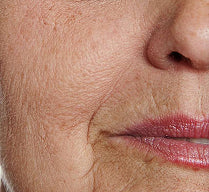 Aging