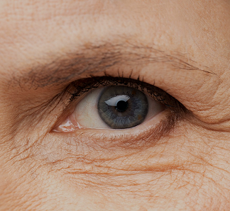 AGING