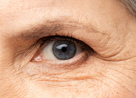 Wrinkles